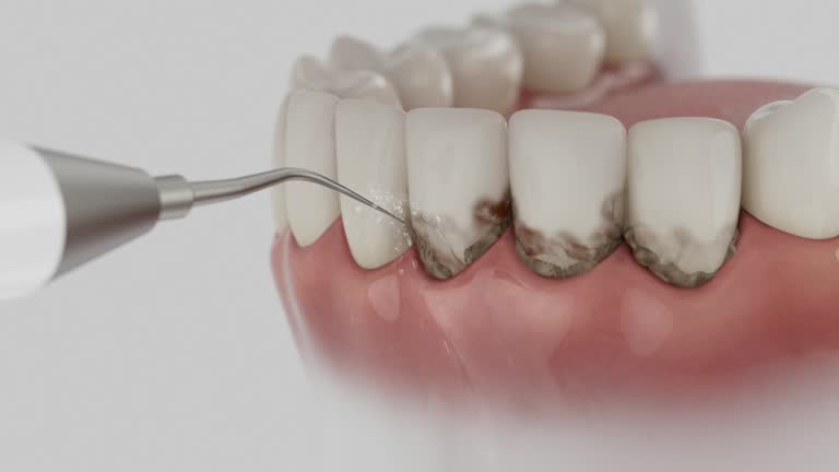 Reliable Dental Implants contractor in Tyler Run, PA by Smile Center Dentistry